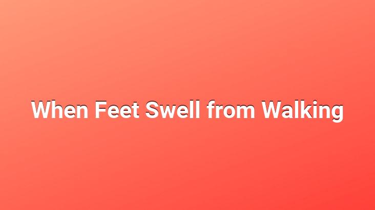 when-feet-swell-from-walking-wordpress-website